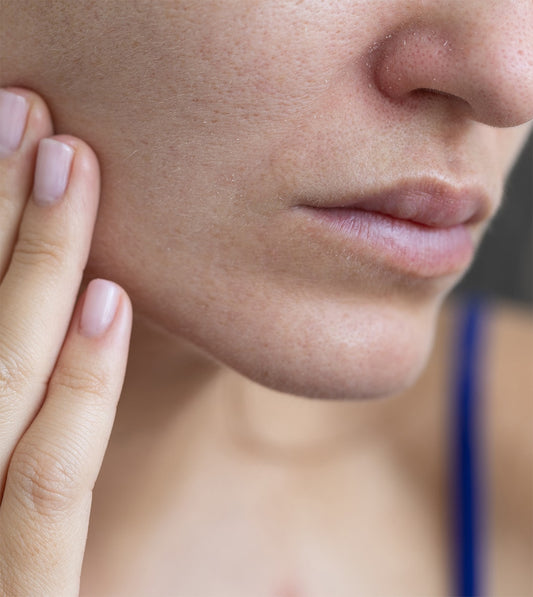 Featured image for the article The Best Skin Care Routine for Dry Skin