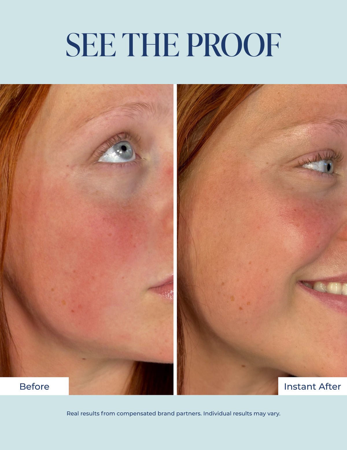 Redness Corrector – Image 3 of 9