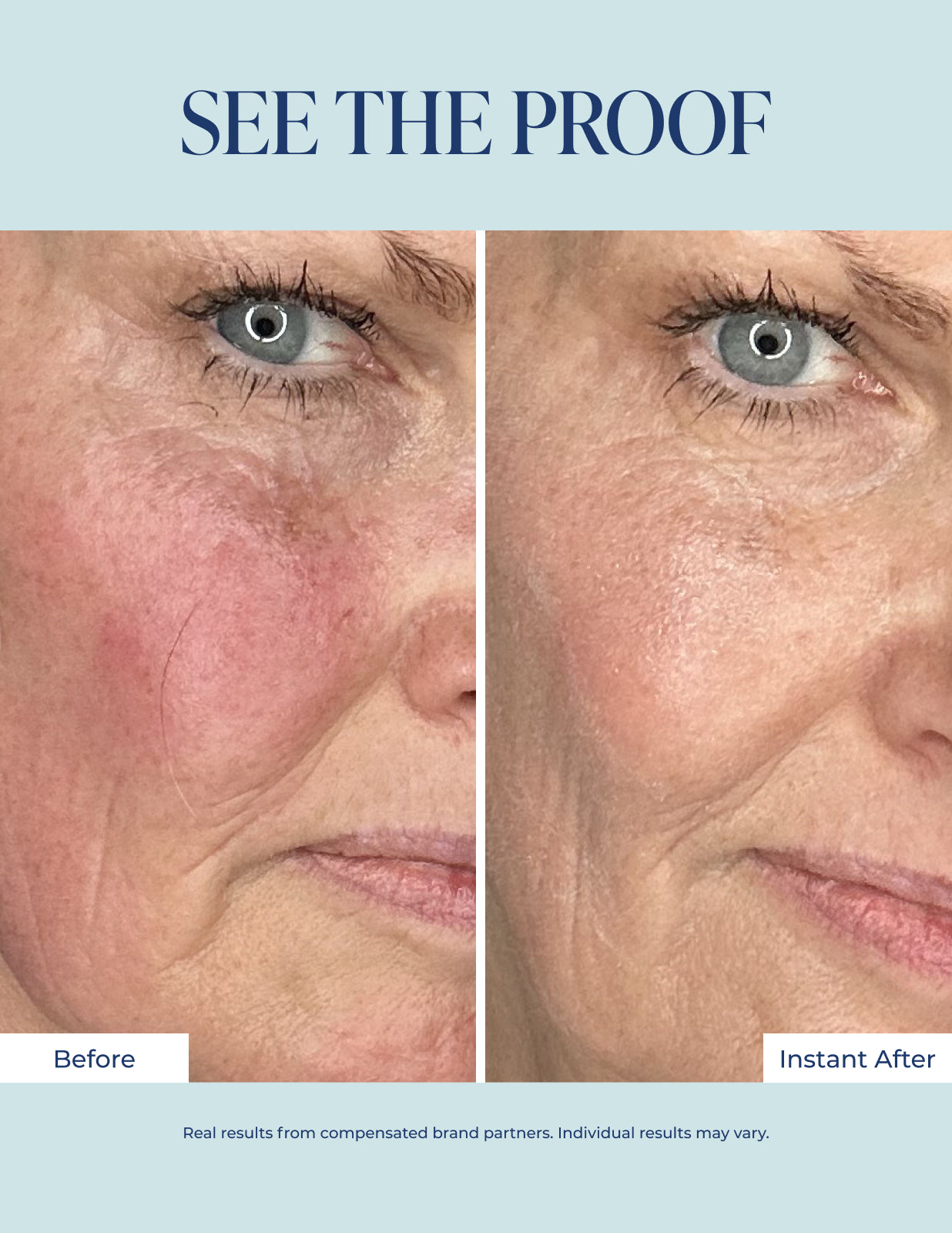 Redness Corrector – Image 4 of 9