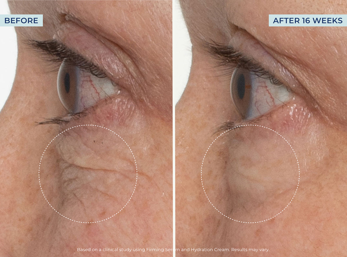 Wrinkle-Fighting Power Trio – Image 6 of 10