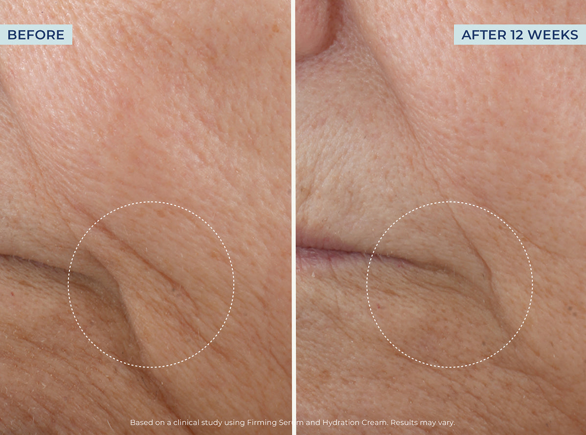 Wrinkle-Fighting Power Trio – Image 9 of 10