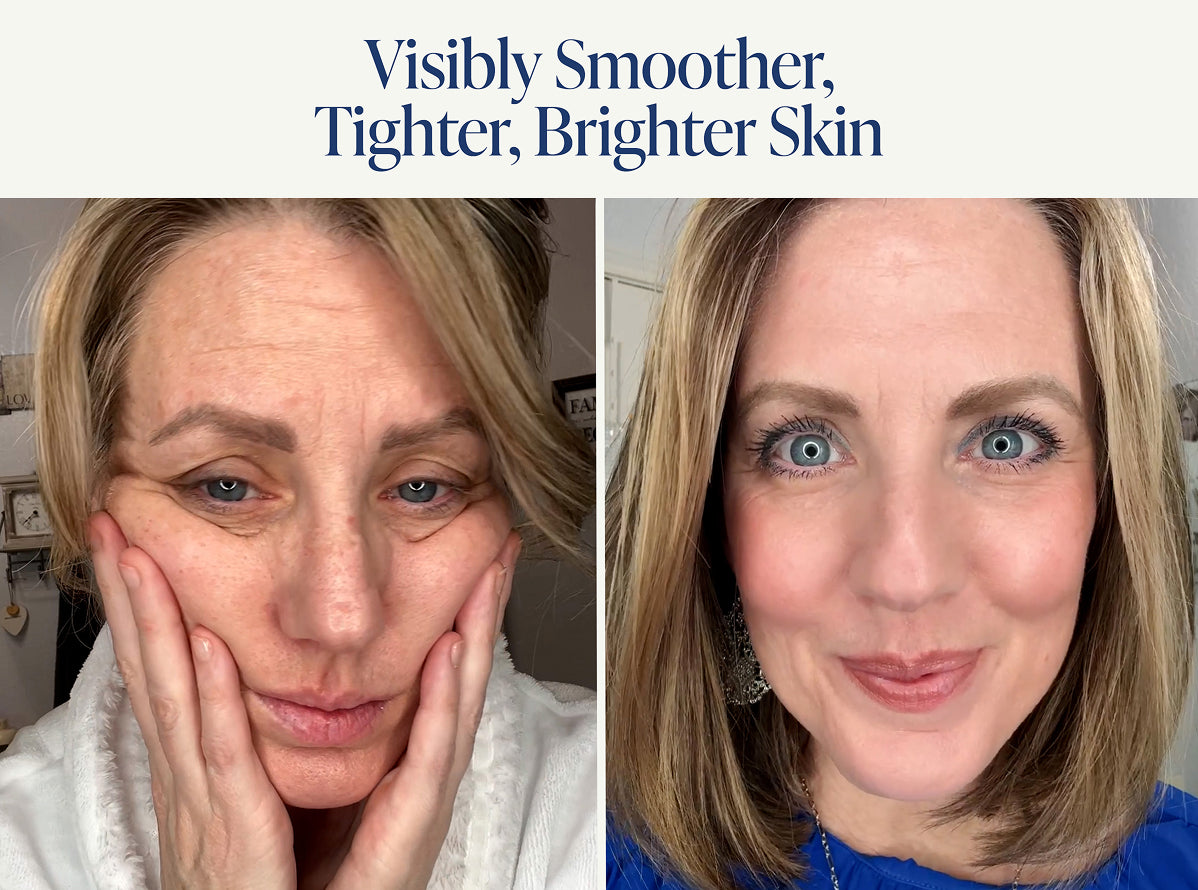 Wrinkle-Fighting Power Trio – Image 10 of 10